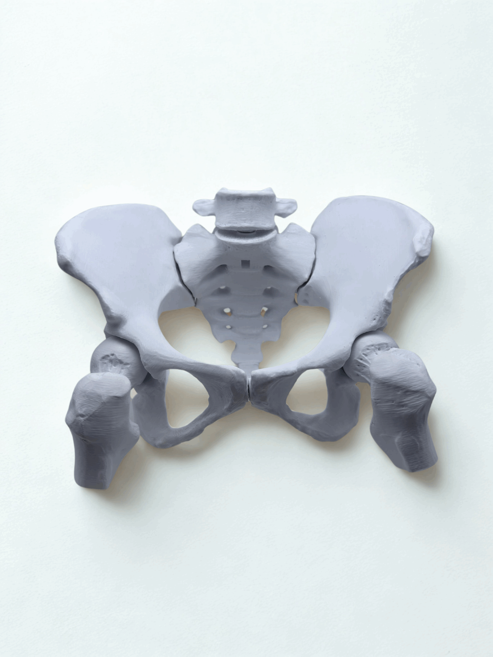 Pelve óssea - Pelve colada - produto sem imã